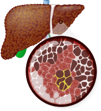 liver